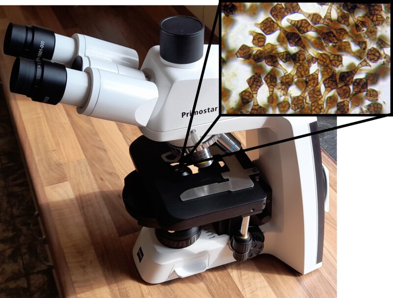 Eine mikroskopische Aufnahme von Pilzsporen überlagert teilweise das Foto eine Lichtmikroskopes.